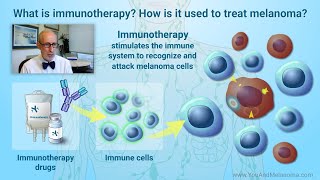 How is melanoma treated with immunotherapy [upl. by Yankee]