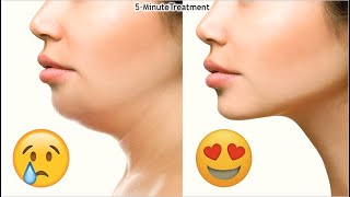 What Are Chin Pimples Ear Blackheads and Nose Whiteheads [upl. by Dayiz]