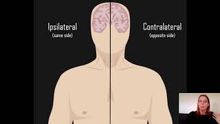 Ipsilateral vs Contralateral [upl. by Anelaf77]