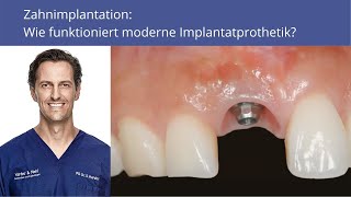 Zahnimplantation Wie funktioniert moderne Implantatprothetik [upl. by Marrissa]