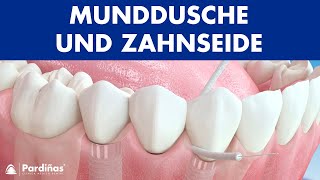 Munddusche und Zahnseide ImplantatPflege © [upl. by Nedroj]