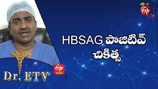 Hbsag Positive  Treatment  Hbsag పాజిటివ్ – చికిత్స  DrETV  2nd June 2022  ETV Life [upl. by Sanfo208]